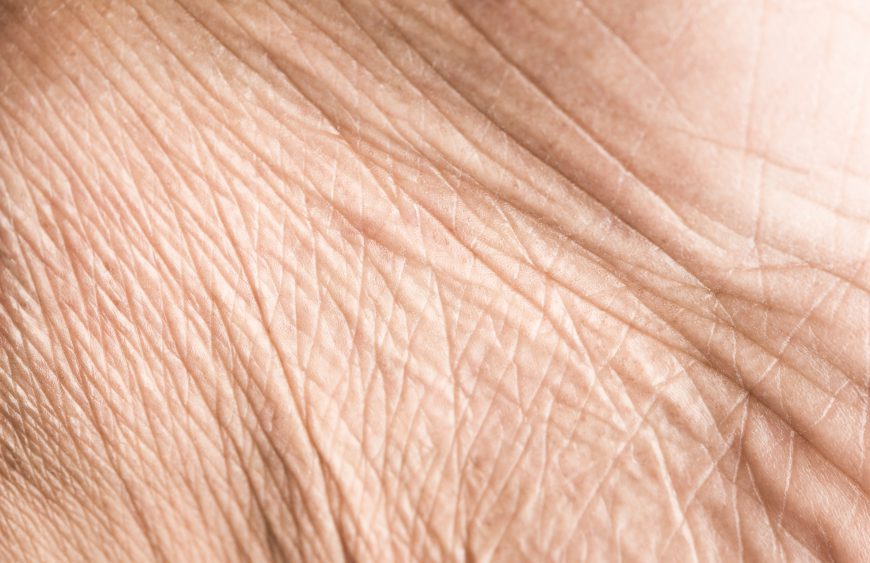 Close,Up,Skin,Texture,With,Wrinkles,On,Body,Human